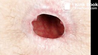 Close-up of dirty assholes in slideshow  1