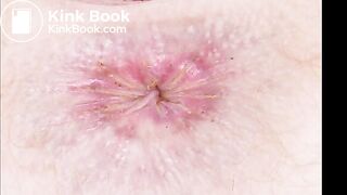 Close-up of dirty assholes in slideshow  1