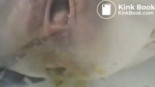 Enema shit