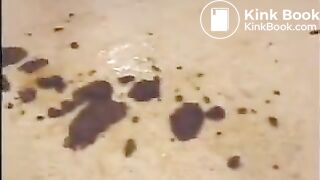 Girl shitting in doctors office