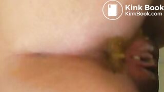 Great diarrhea