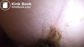 Hairy anal scat fuck