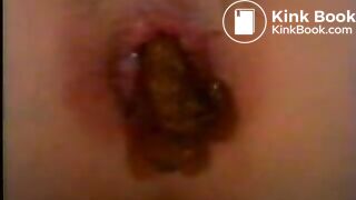 Diarrhea in a table
