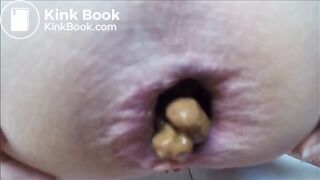 poop35