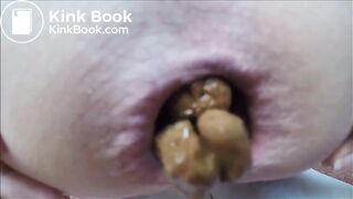 poop35