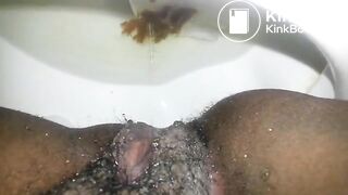 OPHMCUM0022