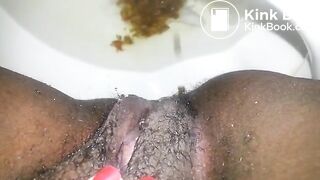 OPHMCUM0022