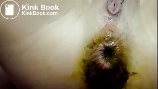 stuff - rosebutt pooping on cam  - MOTHERLES