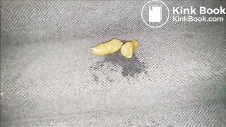 Public Peeing and Pooping in the Hallway