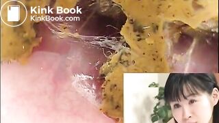 Huge load of shit by a cute japanese girl plus anal camera