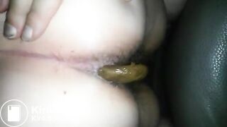 Dirty (nails) amateur