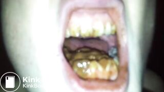 Swallowing Poop