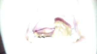 Swallowing Poop