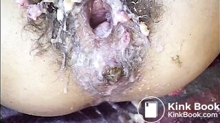 Puked Pussy And Scat