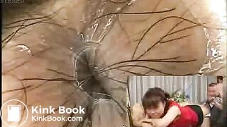 Asian Colonoscopy