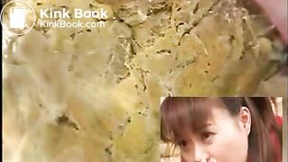 Asian Colonoscopy
