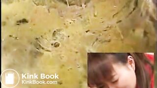 Asian Colonoscopy