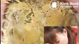 Asian Colonoscopy