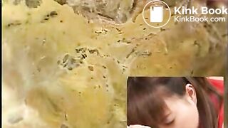 Asian Colonoscopy