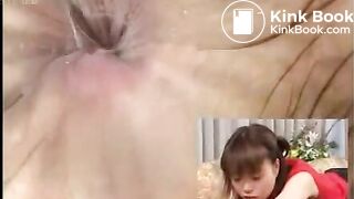 Asian Colonoscopy