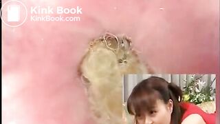 Asian Colonoscopy