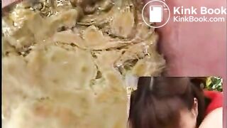 Asian Colonoscopy