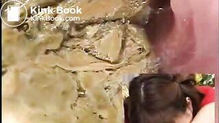 Asian Colonoscopy
