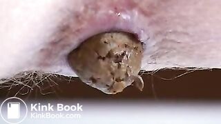 Dianas Scheiße im Zoom