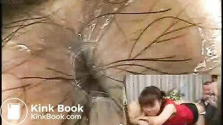 Anus cam