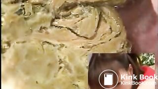 Anus cam