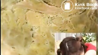 Anus cam