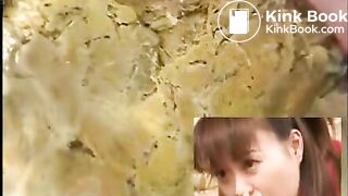 Anus cam