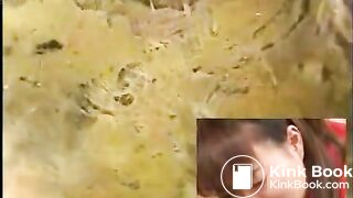 Anus cam