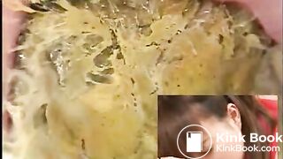 Anus cam