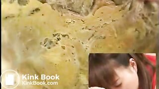 Anus cam
