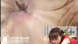 Anus cam