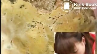 Anus cam