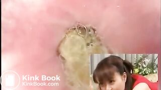 Anus cam