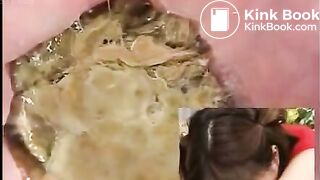 Anus cam