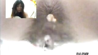 Asshole View 4