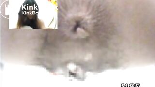 Asshole View 4