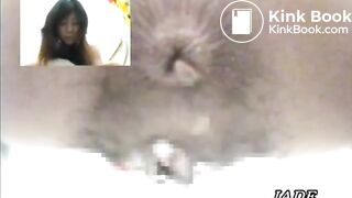 Asshole View 4