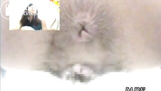 Asshole View 4