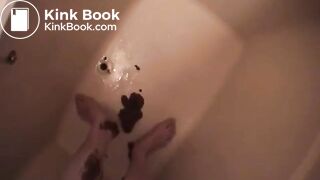 Shit running down the legs