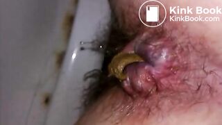 poop3