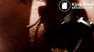 Shitting through speculum