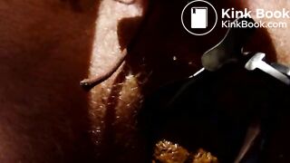 Shitting through speculum