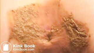 Squashed Shitty Butt Cheeks