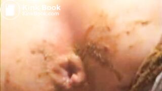 Squashed Shitty Butt Cheeks