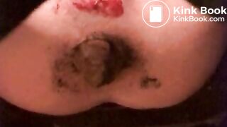 Scat Lucy Eats Ans Speculum - Porn, Sex Tube, Porn Tube, Free Porn, Hardcore Fucking, Porno, Free Porn Videos, Sex, Porn Videos, Adult Dating at NadiasTubecom!